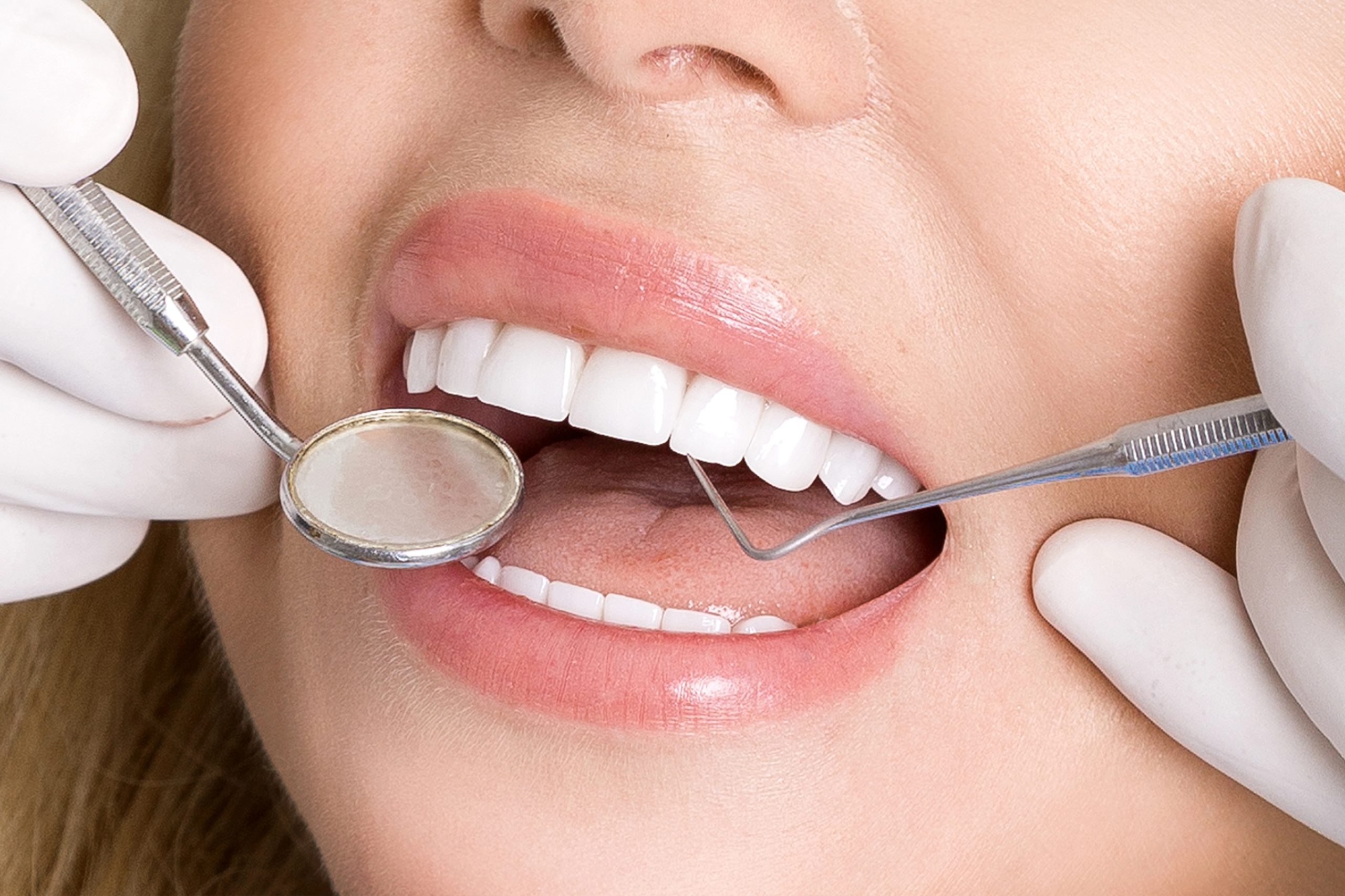 Dental Veneer Specialist Near Me: How to Choose the Right Provider