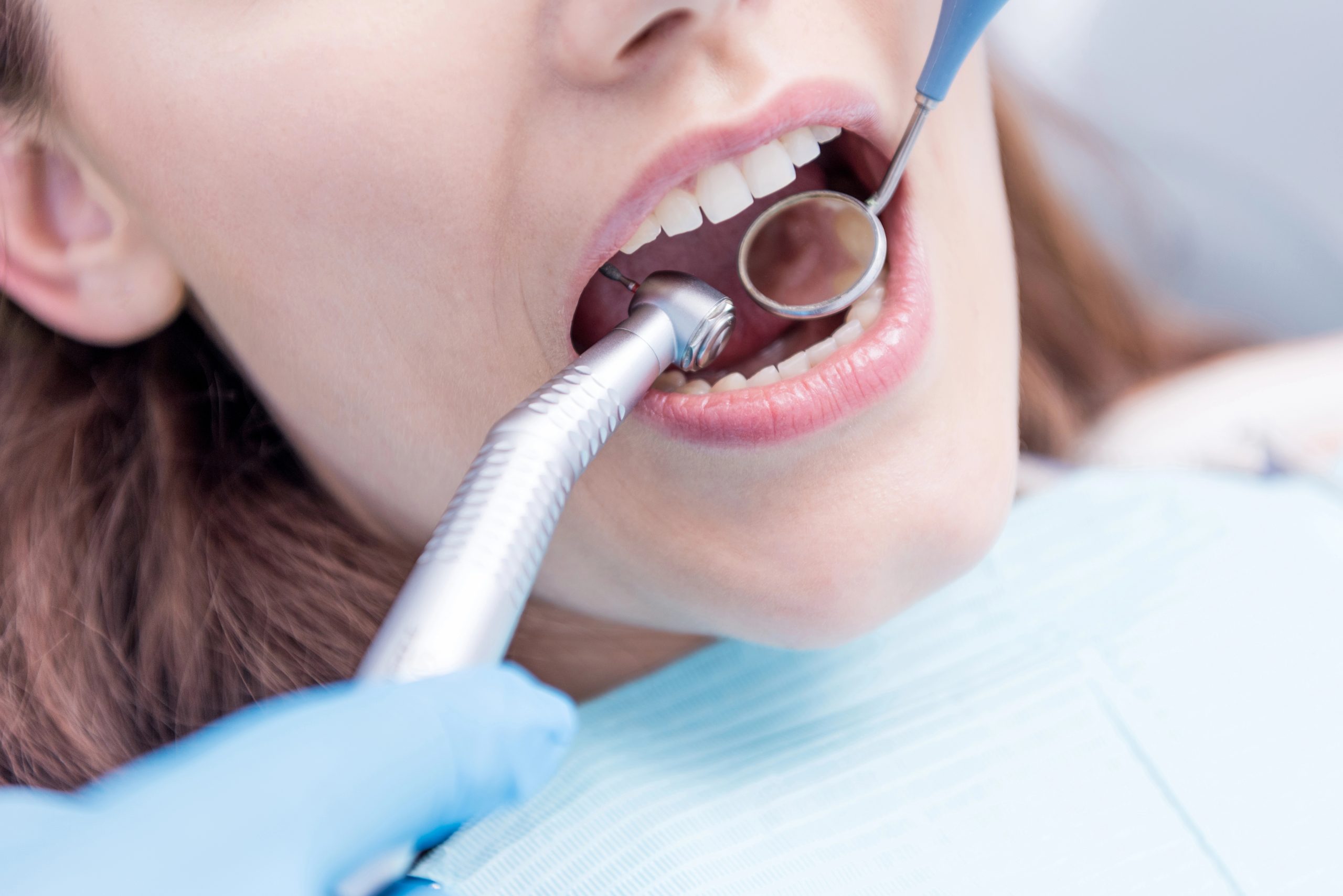 Dental Cleaning and Exam Procedure: What to Expect at Your Visit