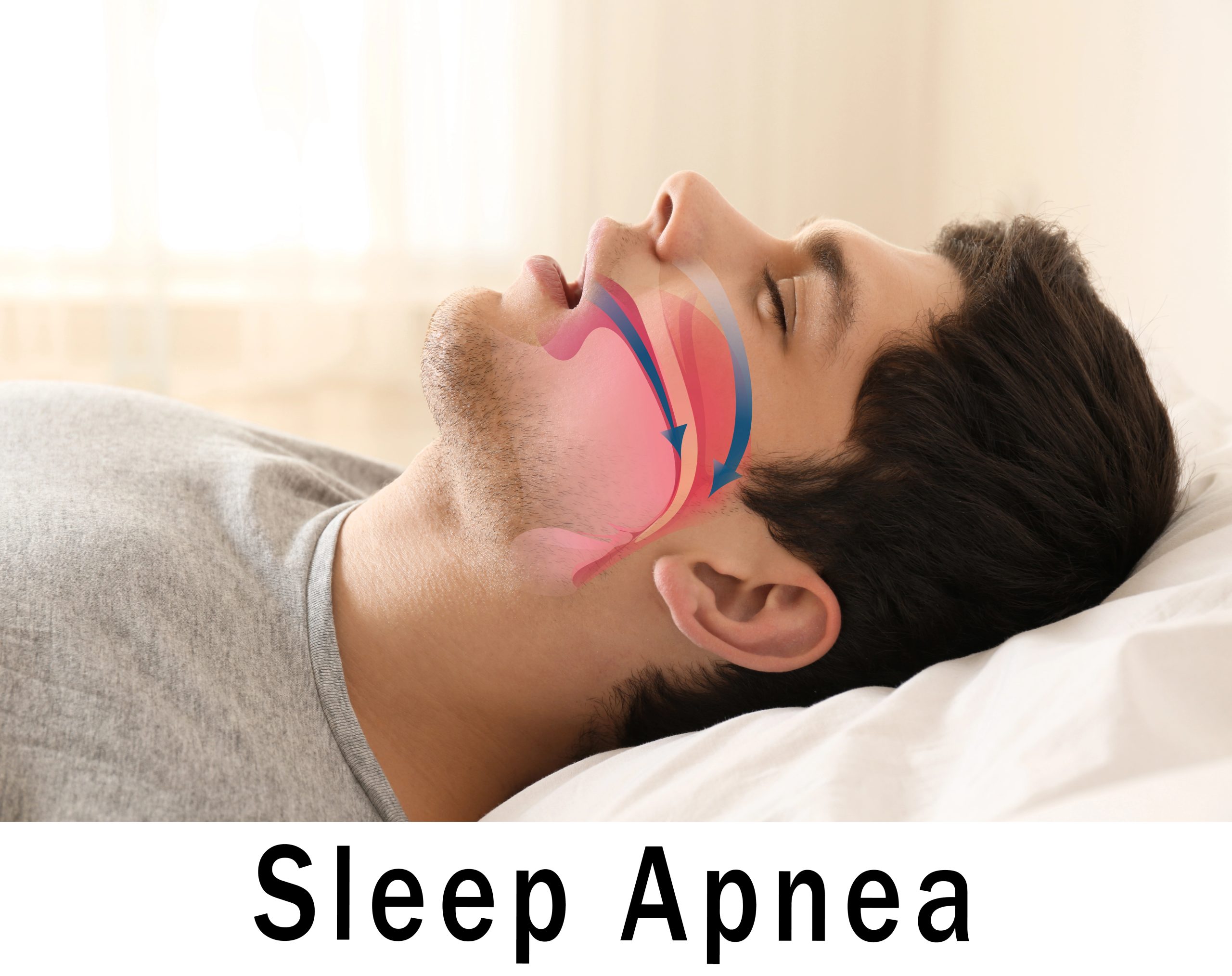 How a Dentist Can Help You Breathe Easier with Sleep Apnea Treatment