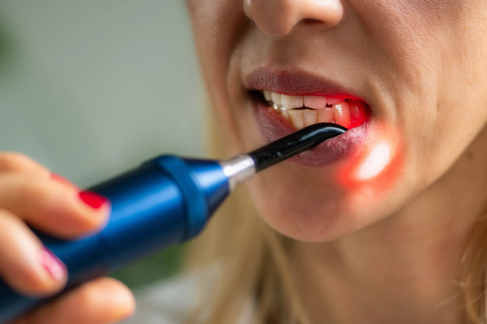 What Is PBM? A Simple Guide to Photobiomodulation Therapy in Dentistry